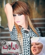 سونيا الكويتية تكشف مأساة تشوه وجهها بعد جراحة تجميل